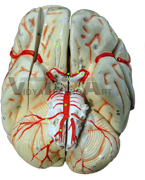 Circle of Willis I